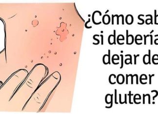 Intolerancia al gluten