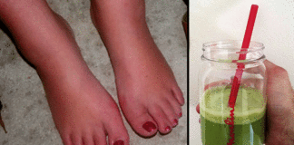 retension de líquidos